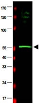 PAB10058 - RAD23B