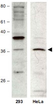 PAB10059 - HUS1B