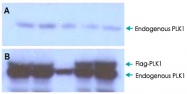 PAB10069 - PLK1