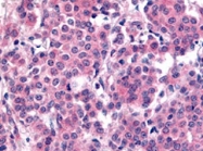 PAB10069 - PLK1