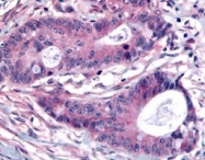 PAB10069 - PLK1