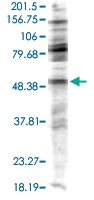 PAB10072 - NEK2