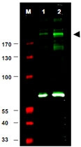 PAB10078 - IRS1