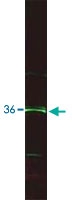PAB10079 - ING5
