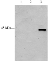 PAB10079 - ING5