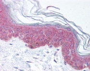 PAB10087 - ASAP1 / DDEF1