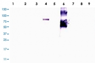 PAB10090 - ANKRD26