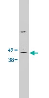 PAB10109 - LASS2