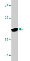 PAB10120 - LY86 / MD-1