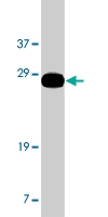 PAB10121 - MD-2