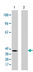 PAB10124 - EDG4 / LPAR2