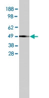 PAB10133 - SLC16A8