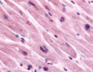 PAB10136 - Muscarinic acetylcholine receptor M3