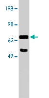 PAB10137 - Netrin-1