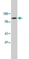 PAB10139 - SLC9A6 / NHE6