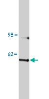 PAB10141 - Notum