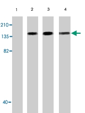 PAB10149 - CD117 / c-kit
