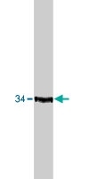 PAB10150 - CDK2
