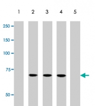 PAB10162 - SRC1