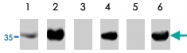 PAB10164 - TP53I3