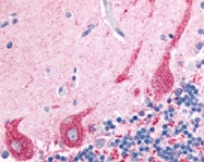 PAB10165 - PRKCZ