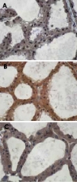 PAB10175 - EIF2AK3