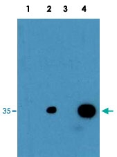 PAB10182 - CEBPD
