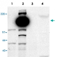 PAB10183 - CASZ1