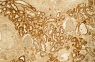 PAB10190 - Collagen type I
