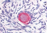 PAB10200 - Delta-like protein 4 / DLL4