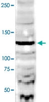 PAB10201 - DIAPH2