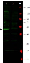 PAB10207 - FBXO5