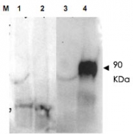 PAB10209 - Seprase / FAP