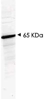 PAB10217 - HDAC1