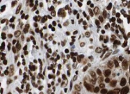 PAB10217 - HDAC1