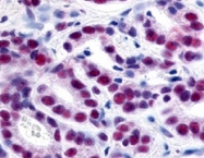 PAB10217 - HDAC1