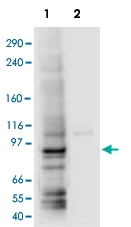 PAB10221 - AP1 complex subunit gamma-1 / AP1G1