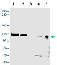 PAB10222 - ATAD5