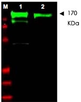 PAB10223 - EGFR / ERBB1