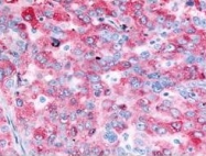 PAB10223 - EGFR / ERBB1