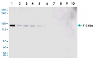 PAB10225 - USP7 / HAUSP