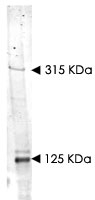 PAB10226 - NIPBL