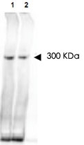 PAB10226 - NIPBL