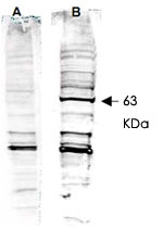 PAB10230 - RAD52