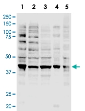 PAB10232 - RNF2