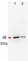 PAB10237 - FBW1B