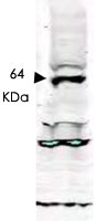 PAB10238 - TLK1