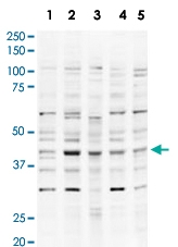 PAB10241 - USP18