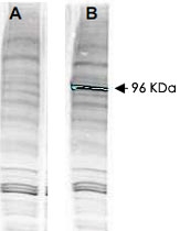 PAB10242 - ATPase WRNIP1