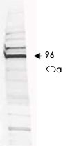 PAB10242 - ATPase WRNIP1